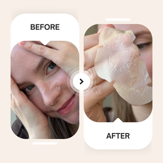 Pores tachetés - Patchs nasaux hydrocolloïdes
